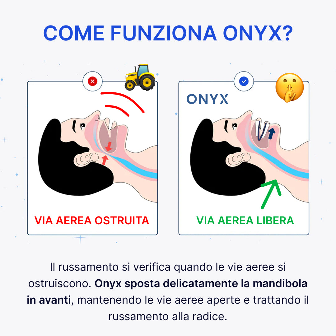 ONYX - Bite Anti-Russamento