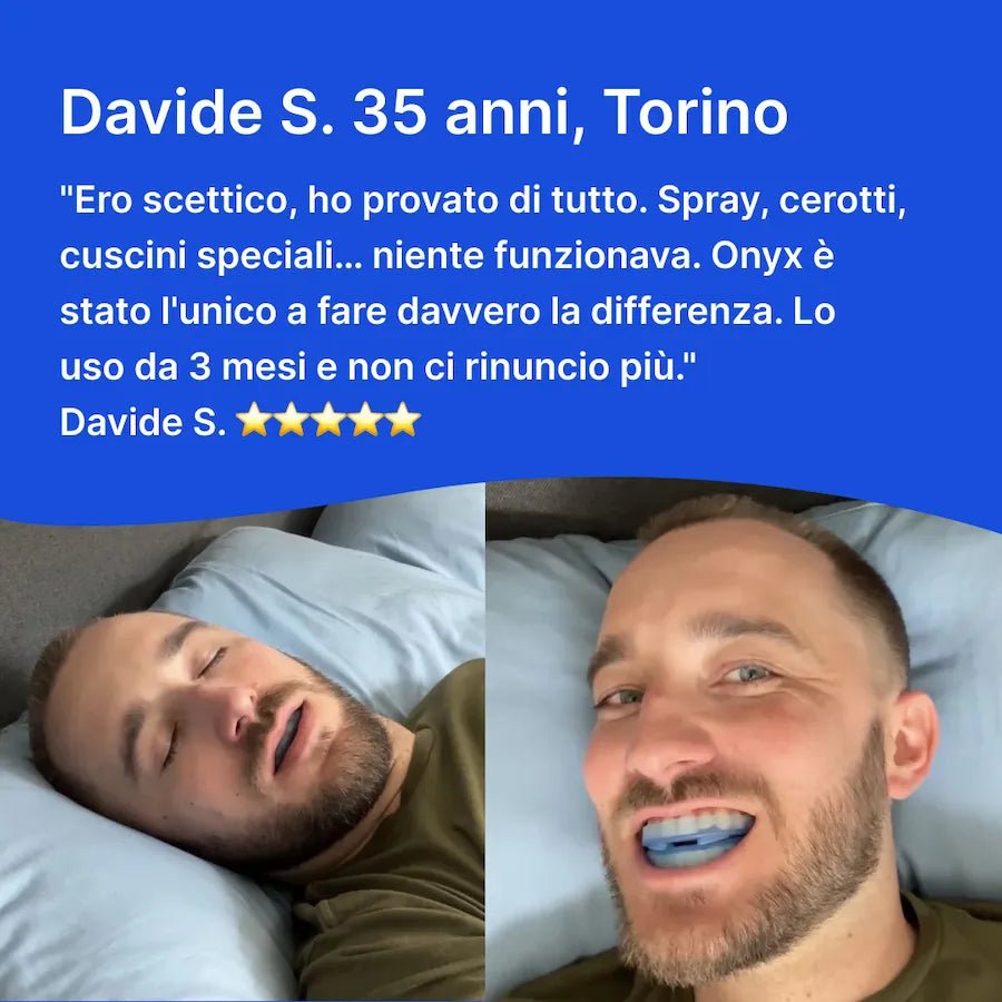 ONYX - Bite Anti - Russamento IN OFFERTA - ONYX Bite Anti - Russamento ITA