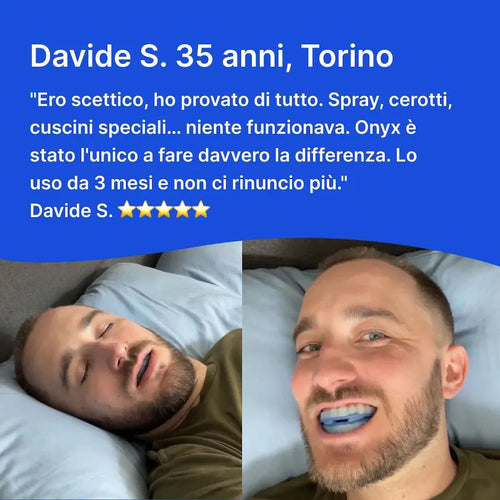 ONYX - Bite Anti - Russamento IN OFFERTA - ONYX Bite Anti - Russamento ITA