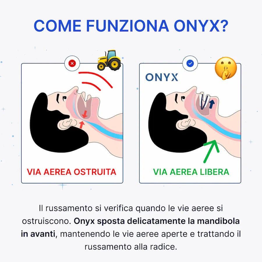 ONYX - Bite Anti - Russamento IN OFFERTA - ONYX Bite Anti - Russamento ITA